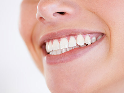 Close-up of a smile showing teeth with an incorrect jaw position, indicated by misaligned bite.