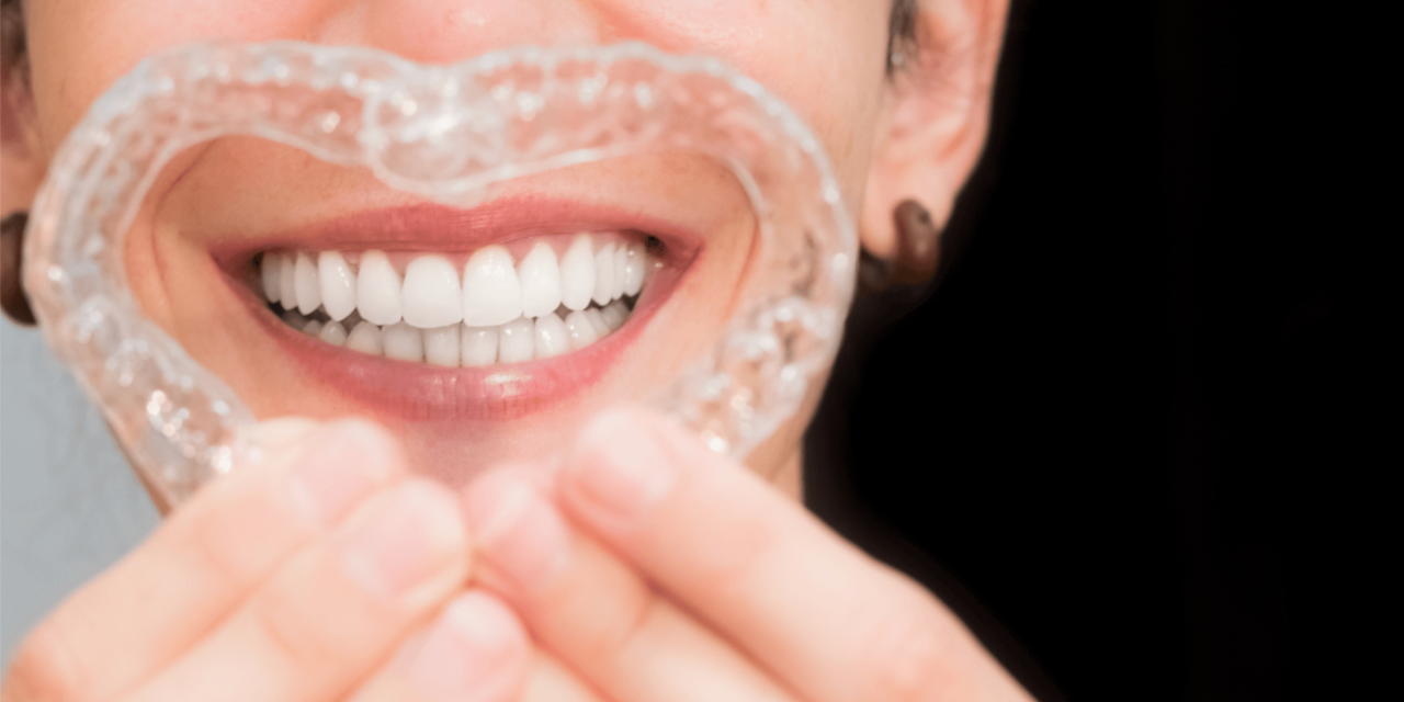Why Consider Orthodontics in Adelaide? Key Benefits of Treatment Explained