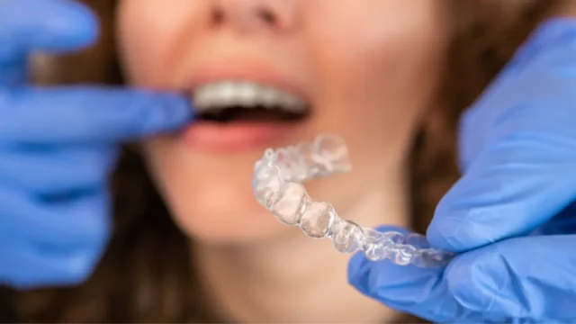 dentist putting in invisalign