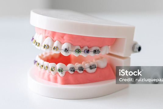 https://www.adelaidebraces.com.au/wp-content/uploads/2024/09/digi-bond.jpg