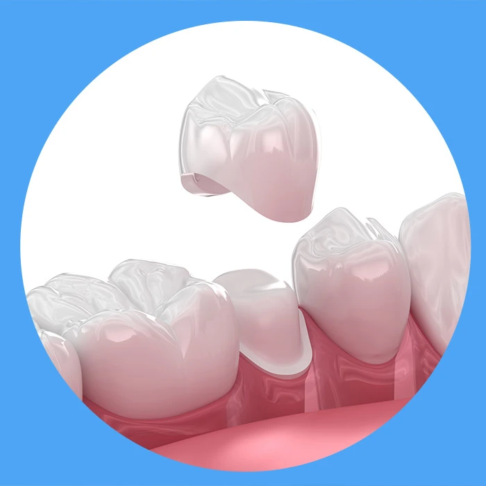 Dental crown