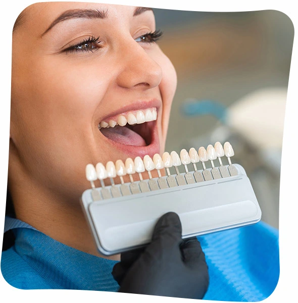 dental veneers pros and cons