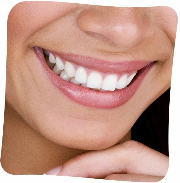 dental whitening cost