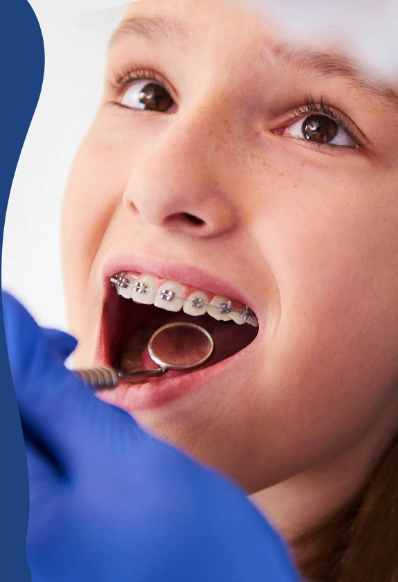 https://www.adelaidebraces.com.au/wp-content/uploads/2025/01/kids-bracesimg.webp