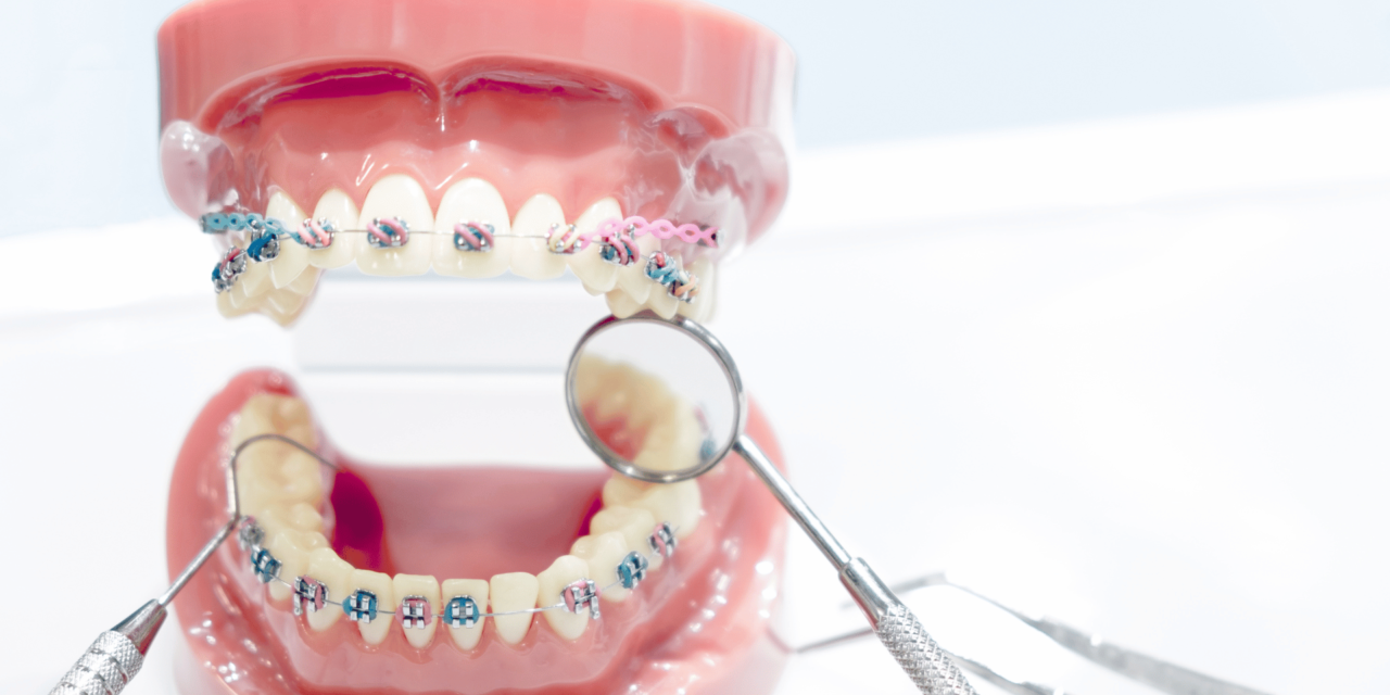 5 Ways to Prepare for Your First Orthodontic Appointment in Adelaide